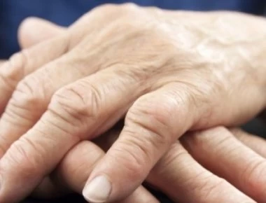 Ουρική αρθρίτιδα: Τι να κάνετε για να μειώσετε το ουρικό οξύ